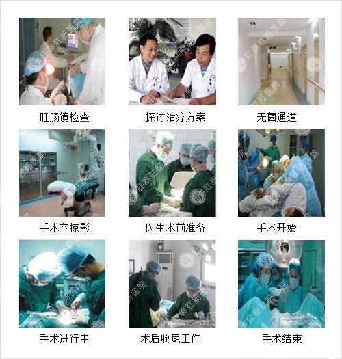 智能PPH技术过程图片