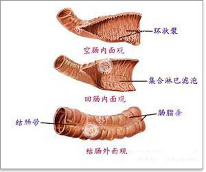 结肠炎