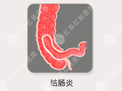 慢性结肠炎